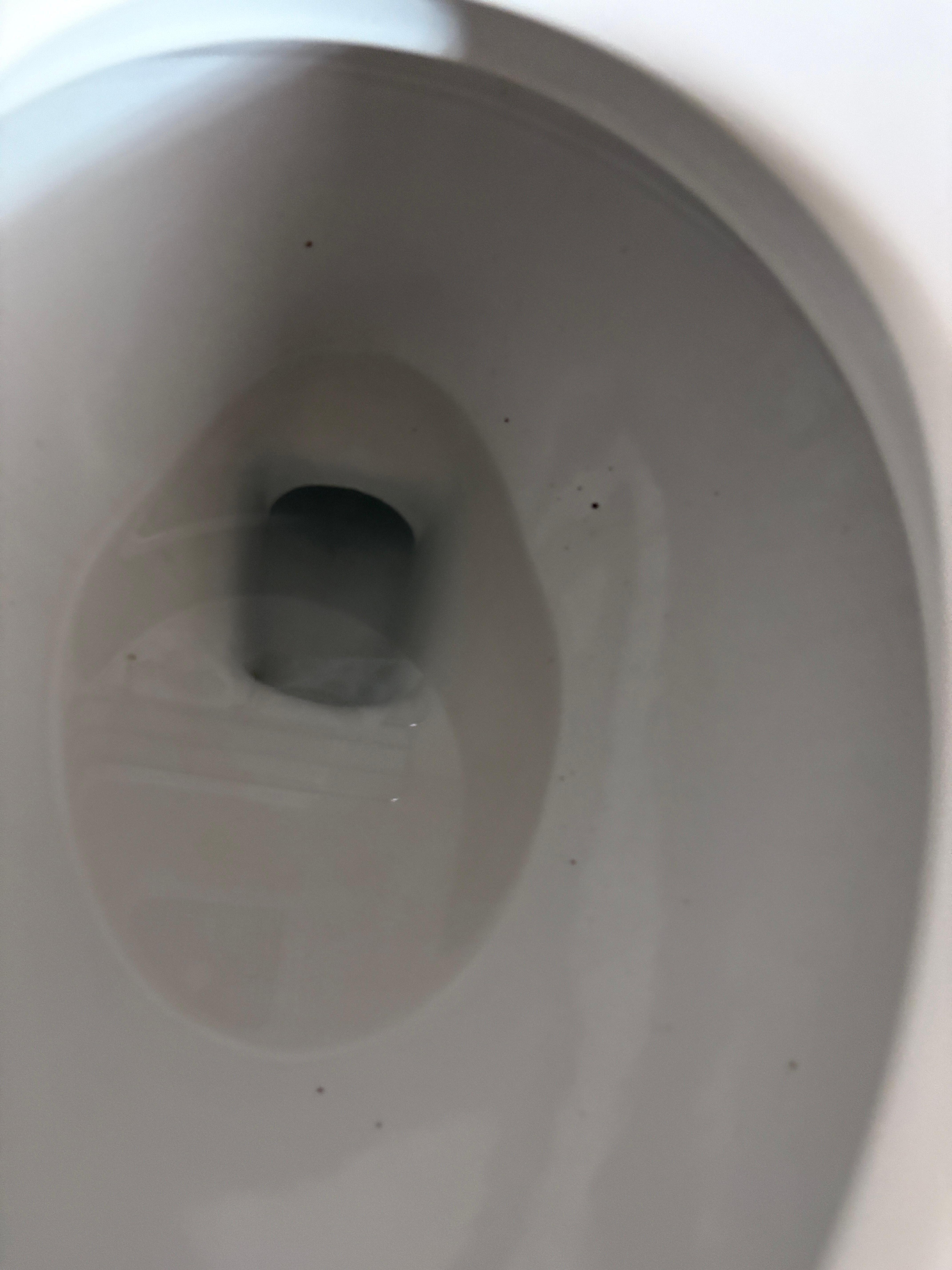 Feces splatter