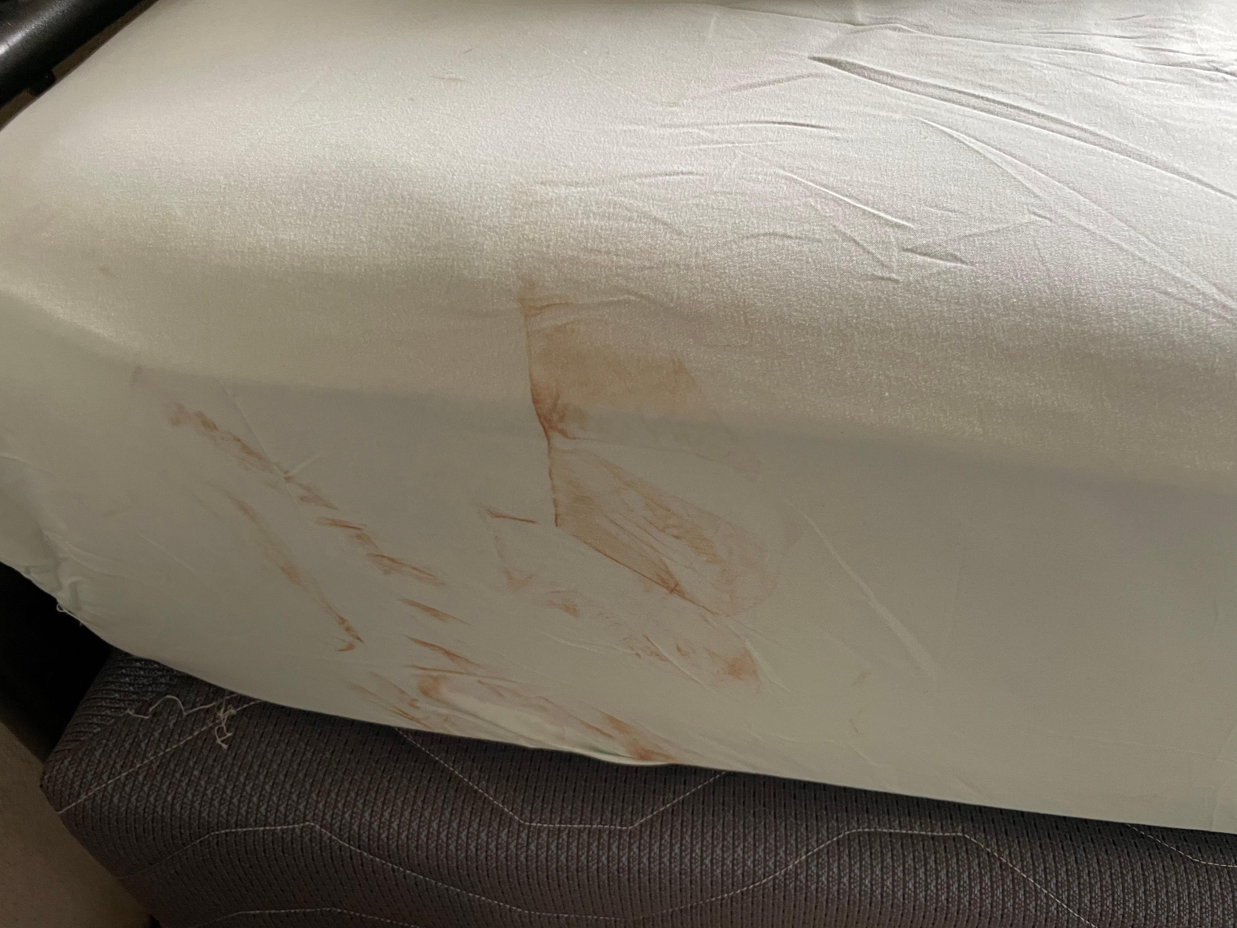 What...are these stains on the sheets.  😩