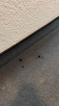 Blutspuren und kleine weiße Würmer drum herum