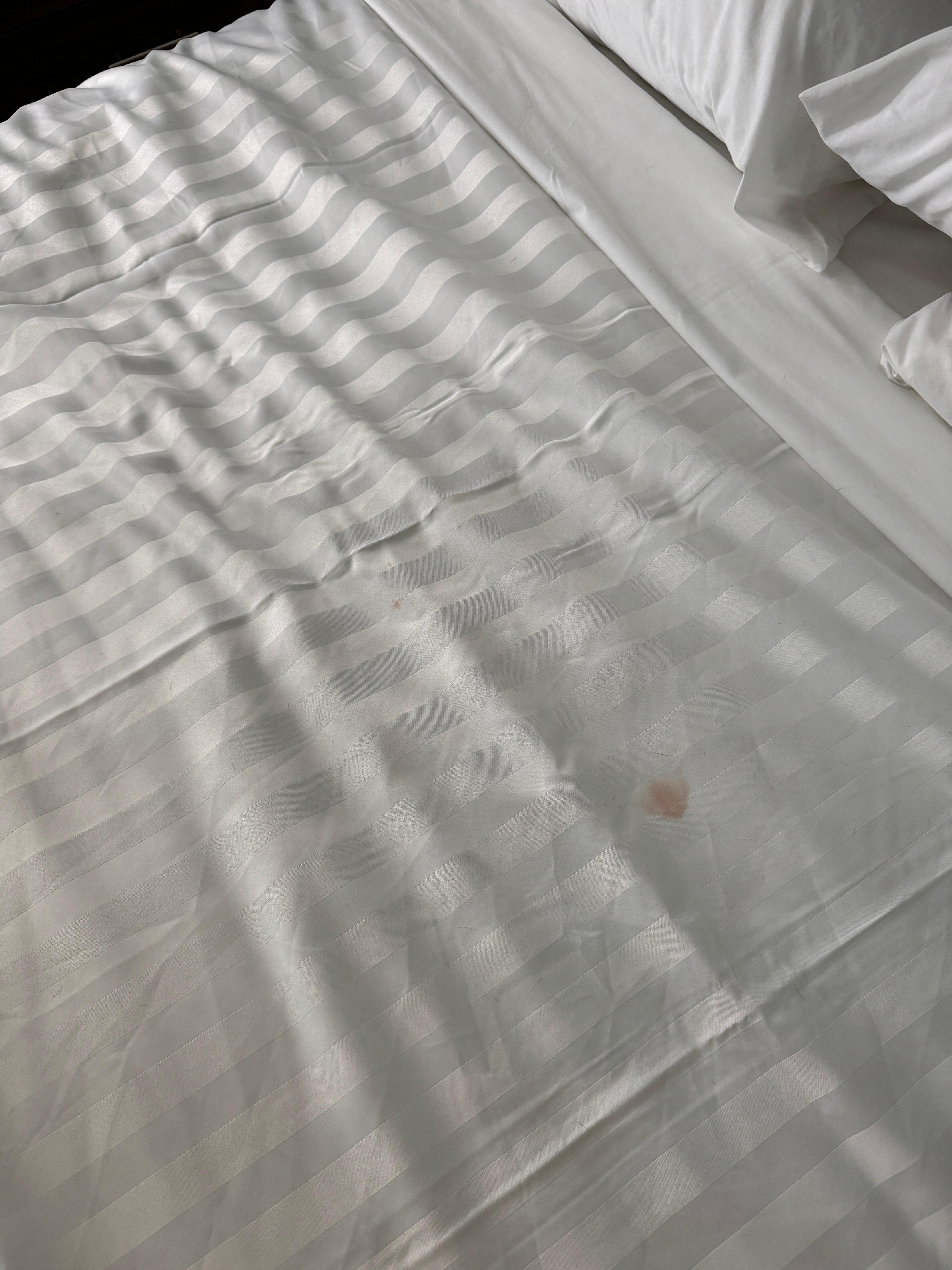 Surface stains on the sheets, I couldn’t bear to take a photo of the bottom sheet it was so disgusting. 