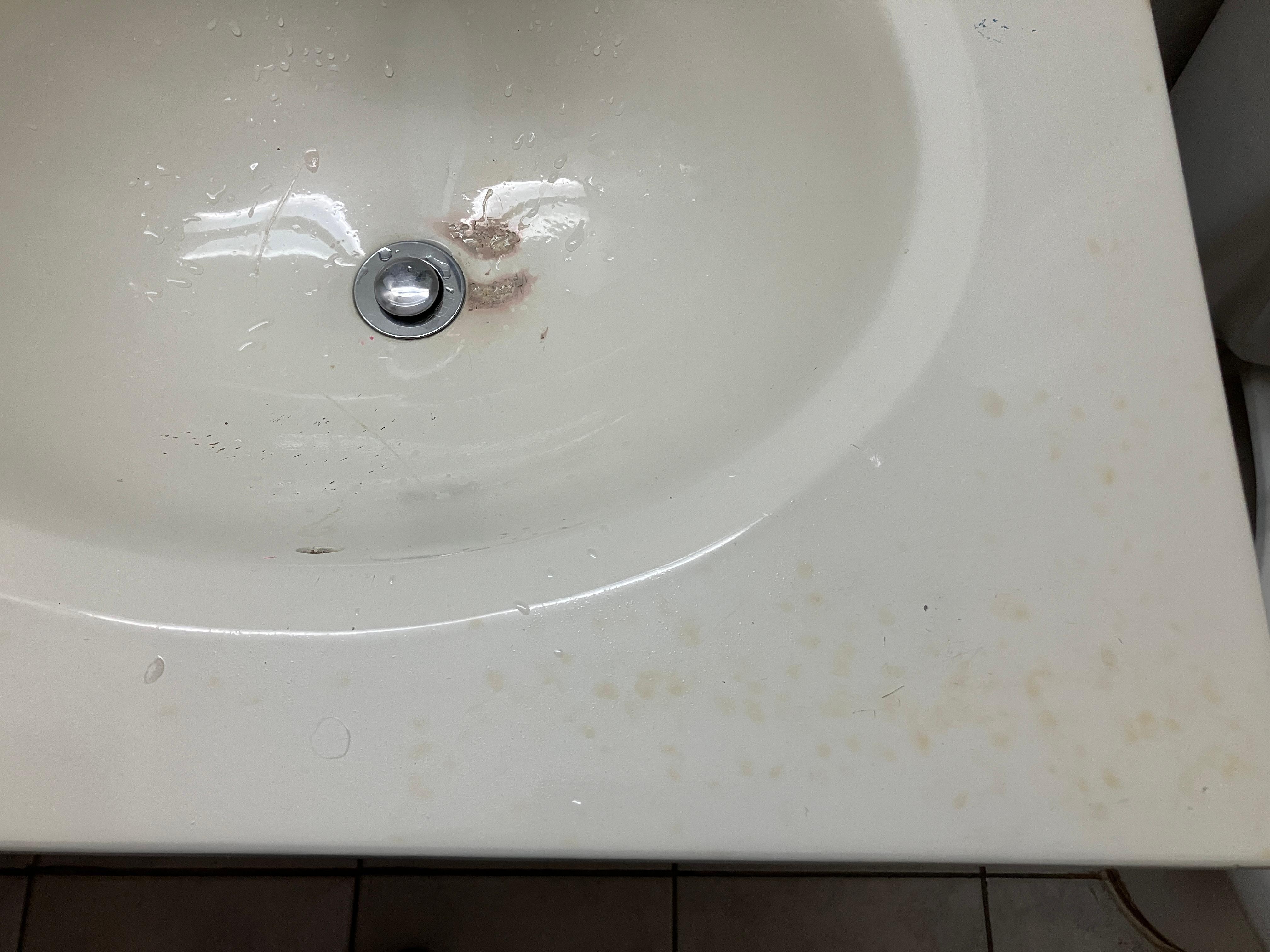 Vasken burde vært skiftet ut for lenge siden og det drypper fra kranen