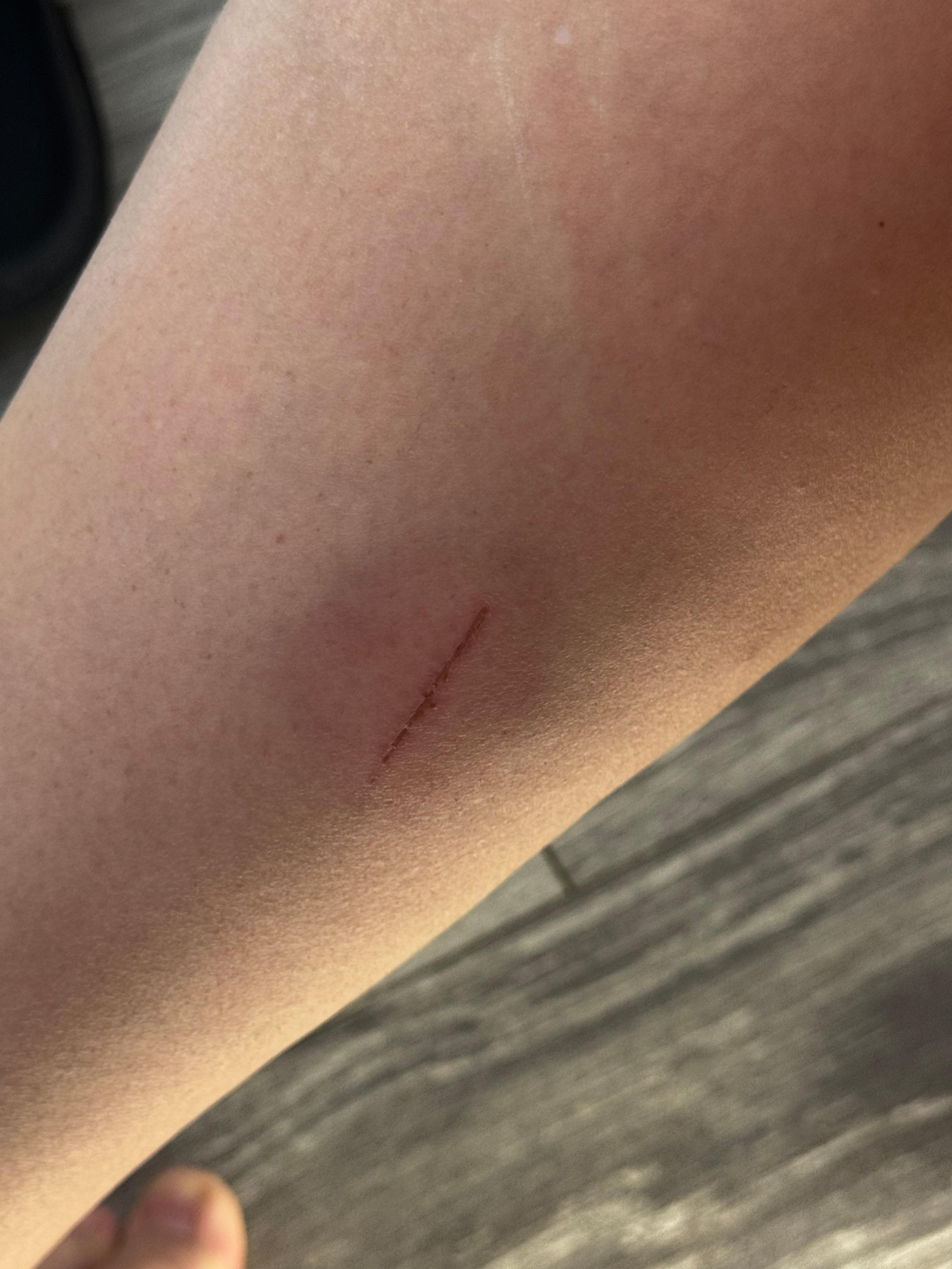 My leg after open the couch !