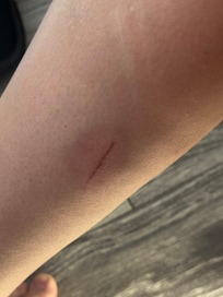 My leg after open the couch !
