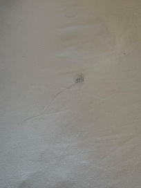 Pubic Hair