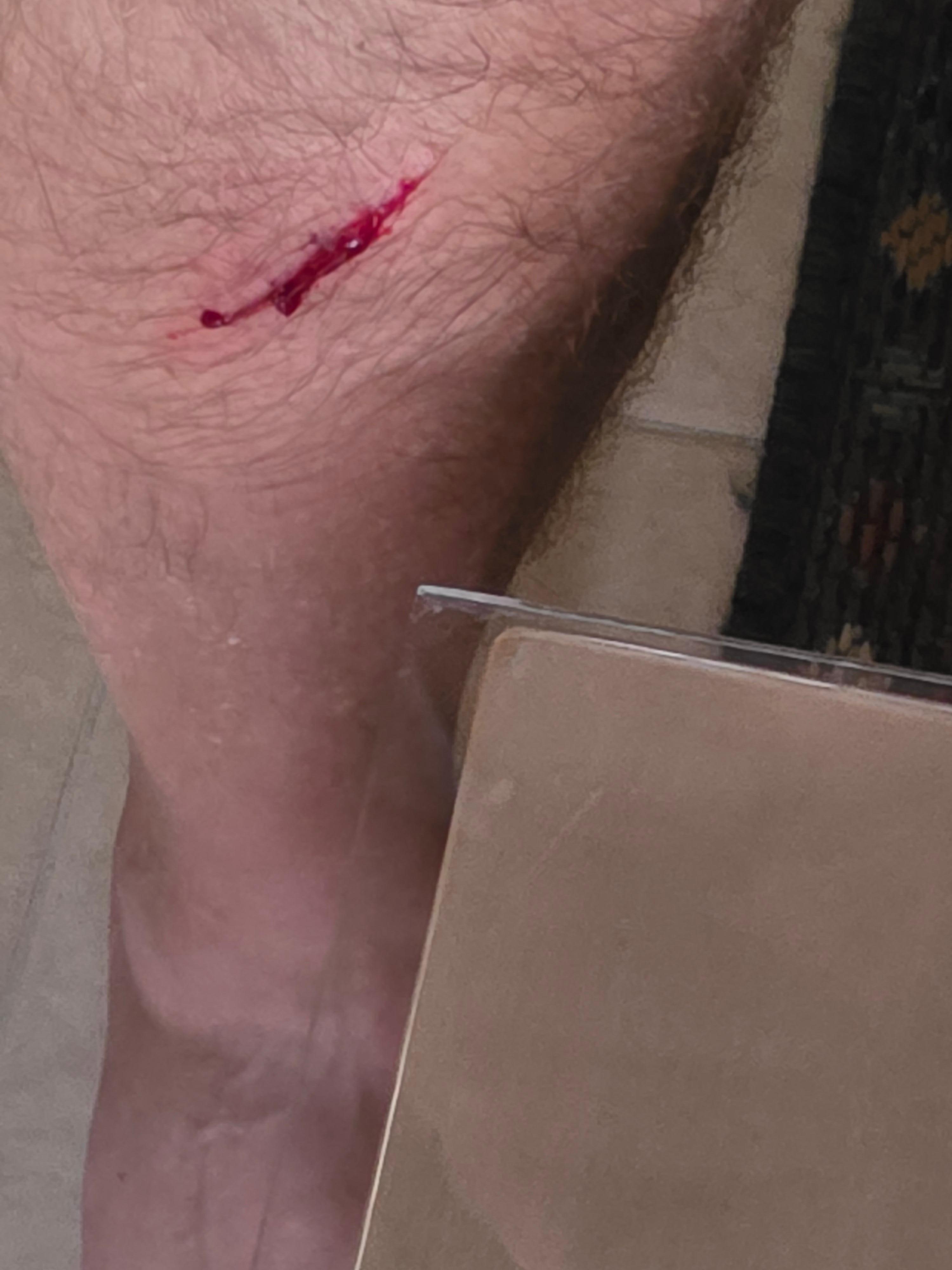 Deep damage to my leg due to Owners Negligence and putting sharp Unfinished Glass on a table