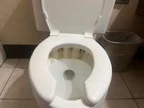 Toilet that had extreme stains