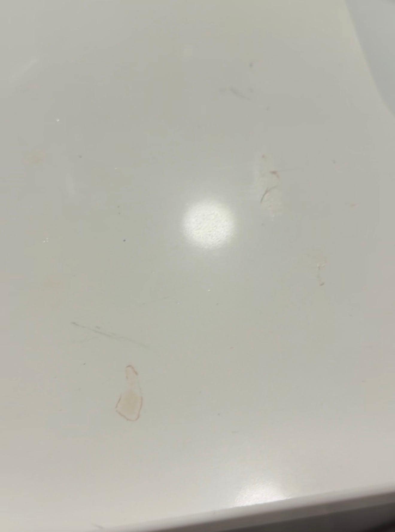 Gross spots on the sink 