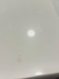 Gross spots on the sink