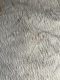 Blood stains on blanket?