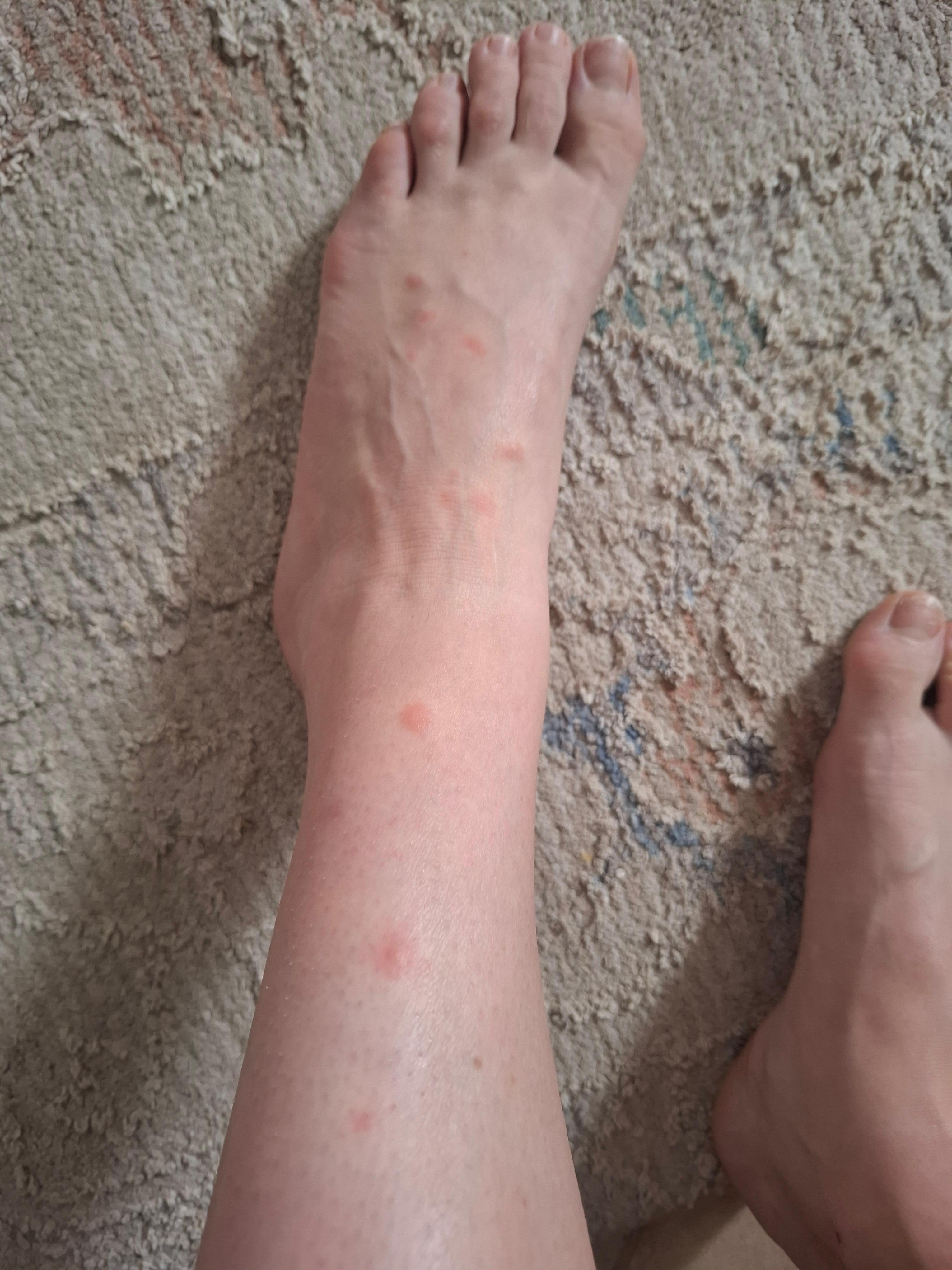 Loaded with bedbugs.