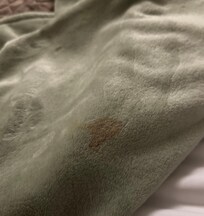Stain on blanket