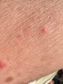 They showed up 2 to 5 days later, but previous reviews showed bedbugs.