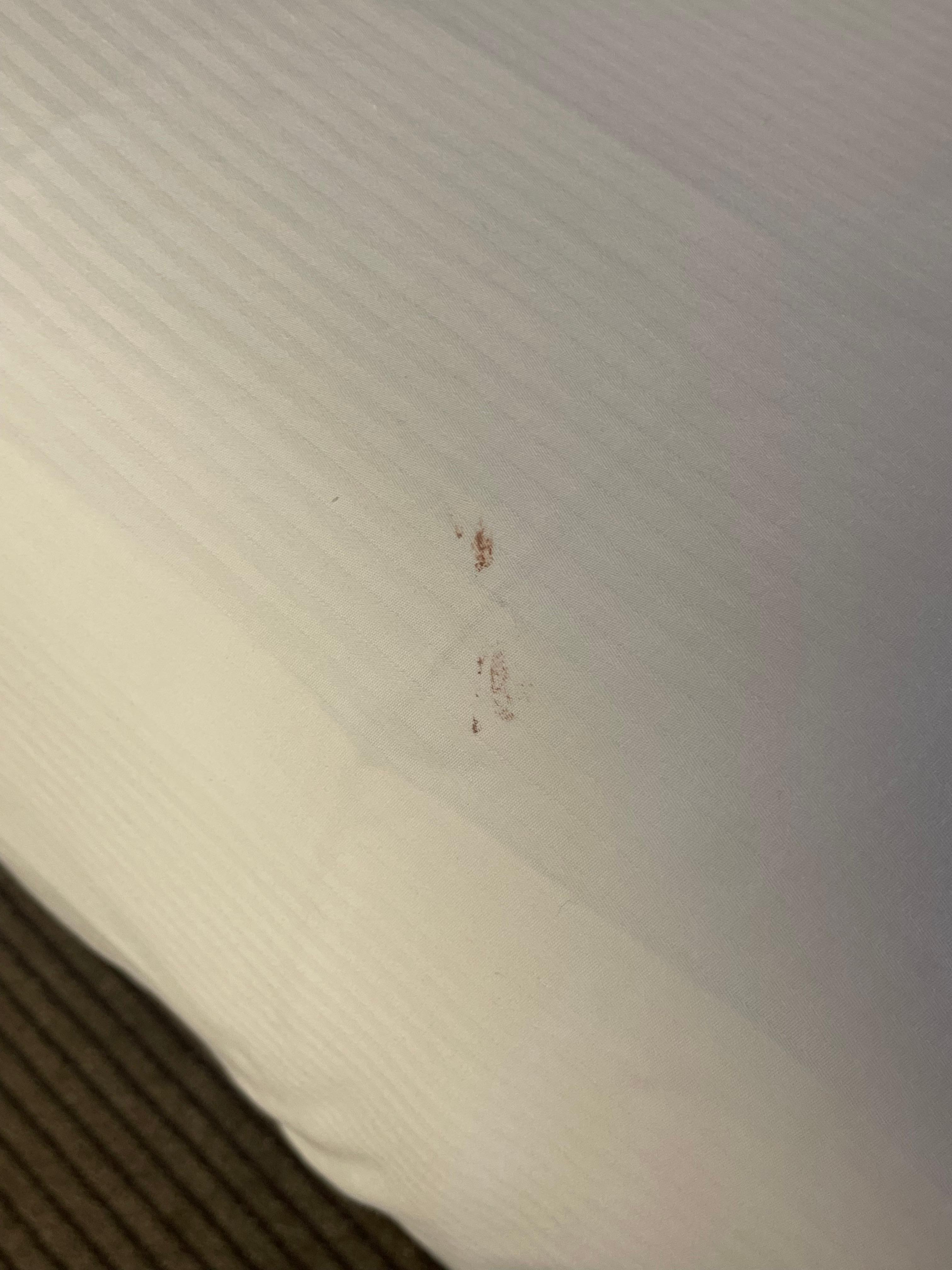 Blood on sheets