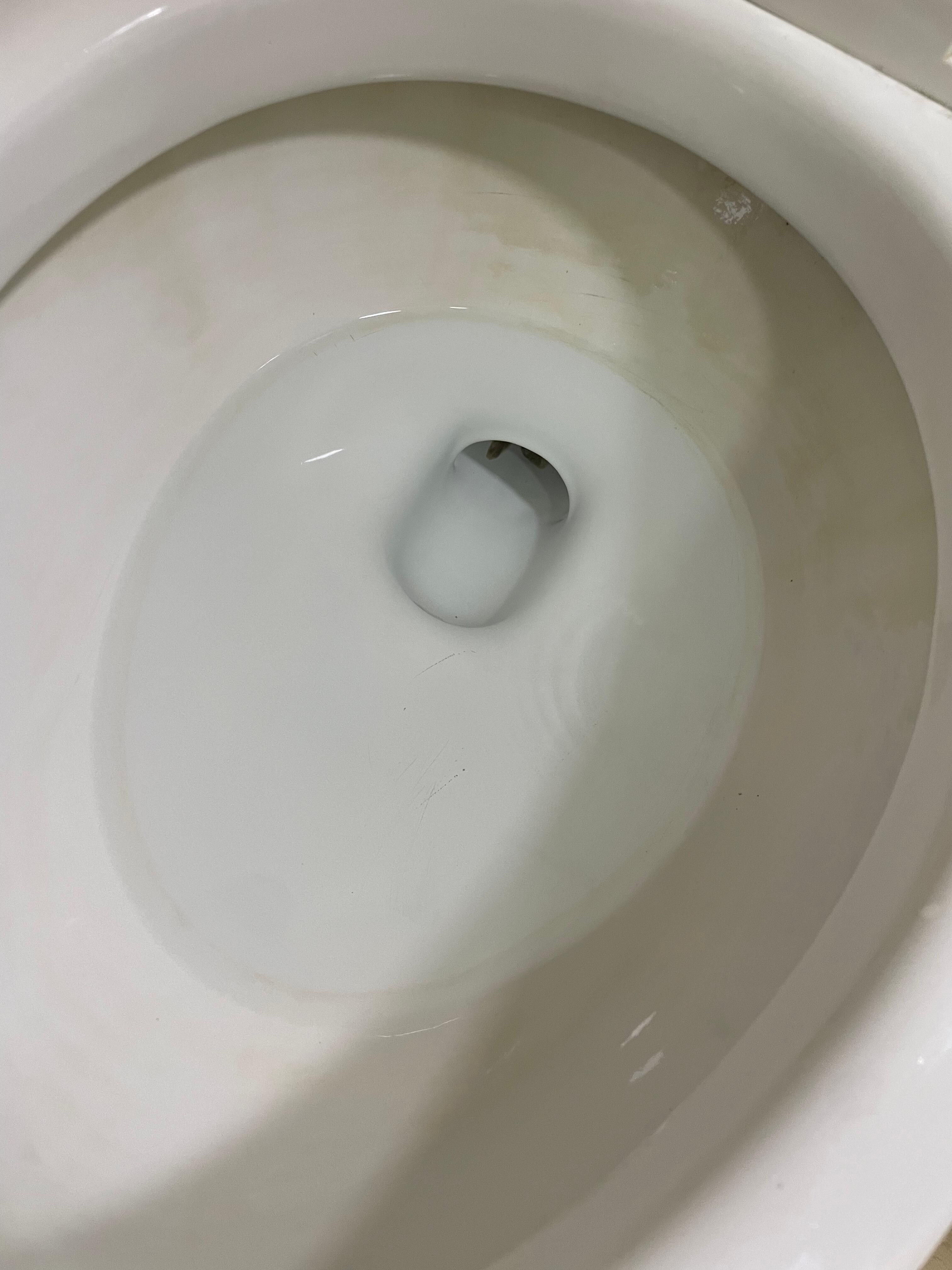 Dirty toilet bowl 