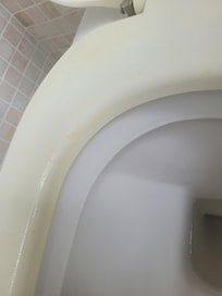 Uralter, vergilbter, fleckiger WC-Sitz