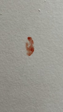 Sangre en las paredes