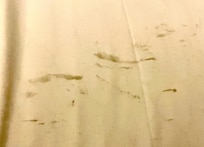 Black marks on the bed sheet.