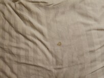 Blood stain on pillow.