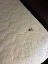 Dry blood on the bed