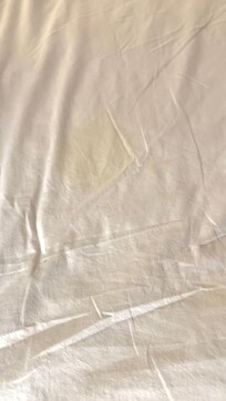 More large yellow stains on sheets