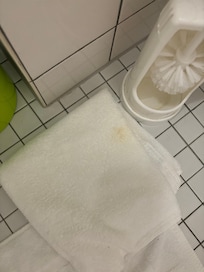 Just one of the stained towels, three out of the four we had, mind you the first two were replaced when housekeeping came, were stained.