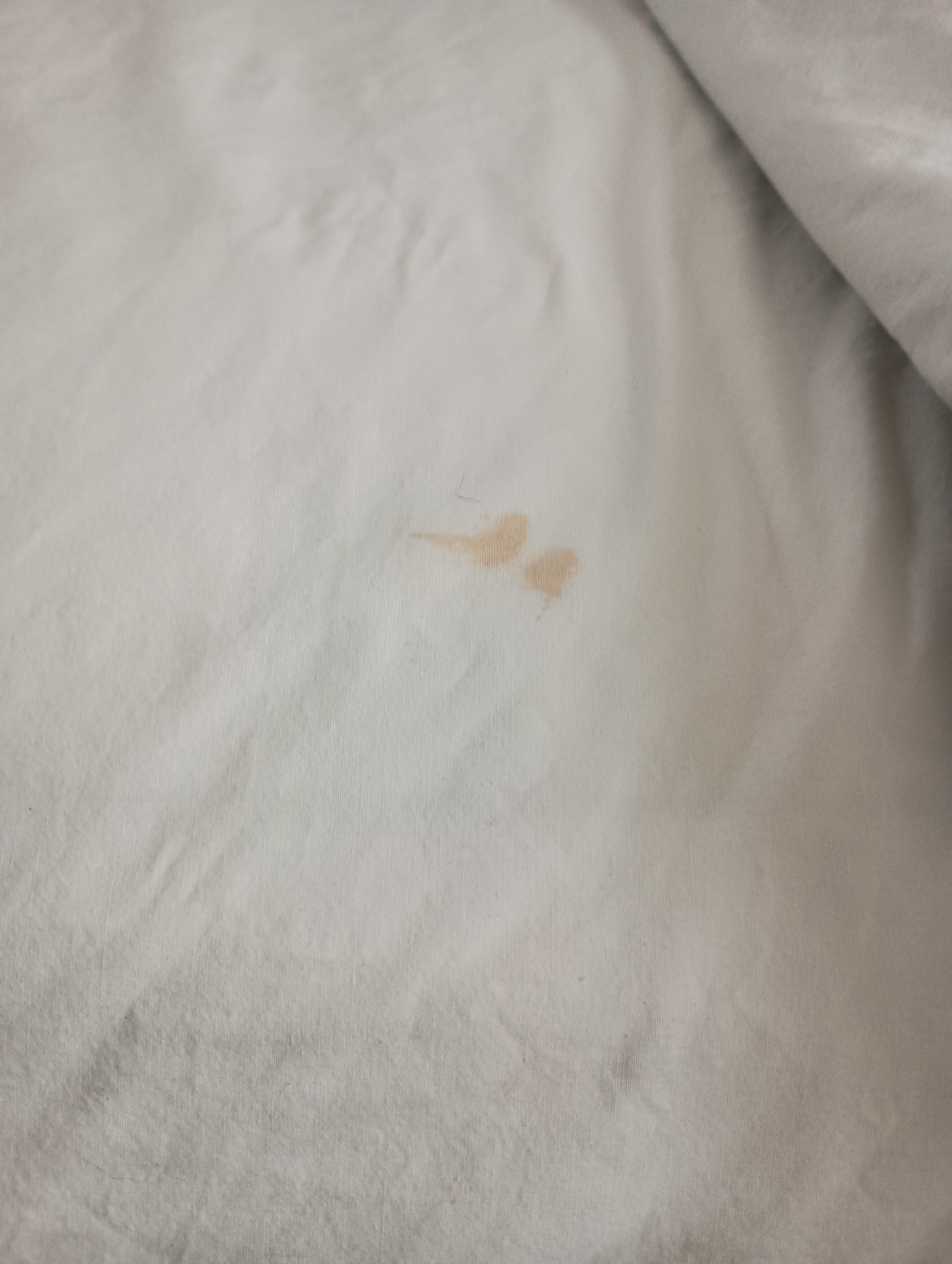 Stain on the bed