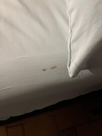 Stains on master bed