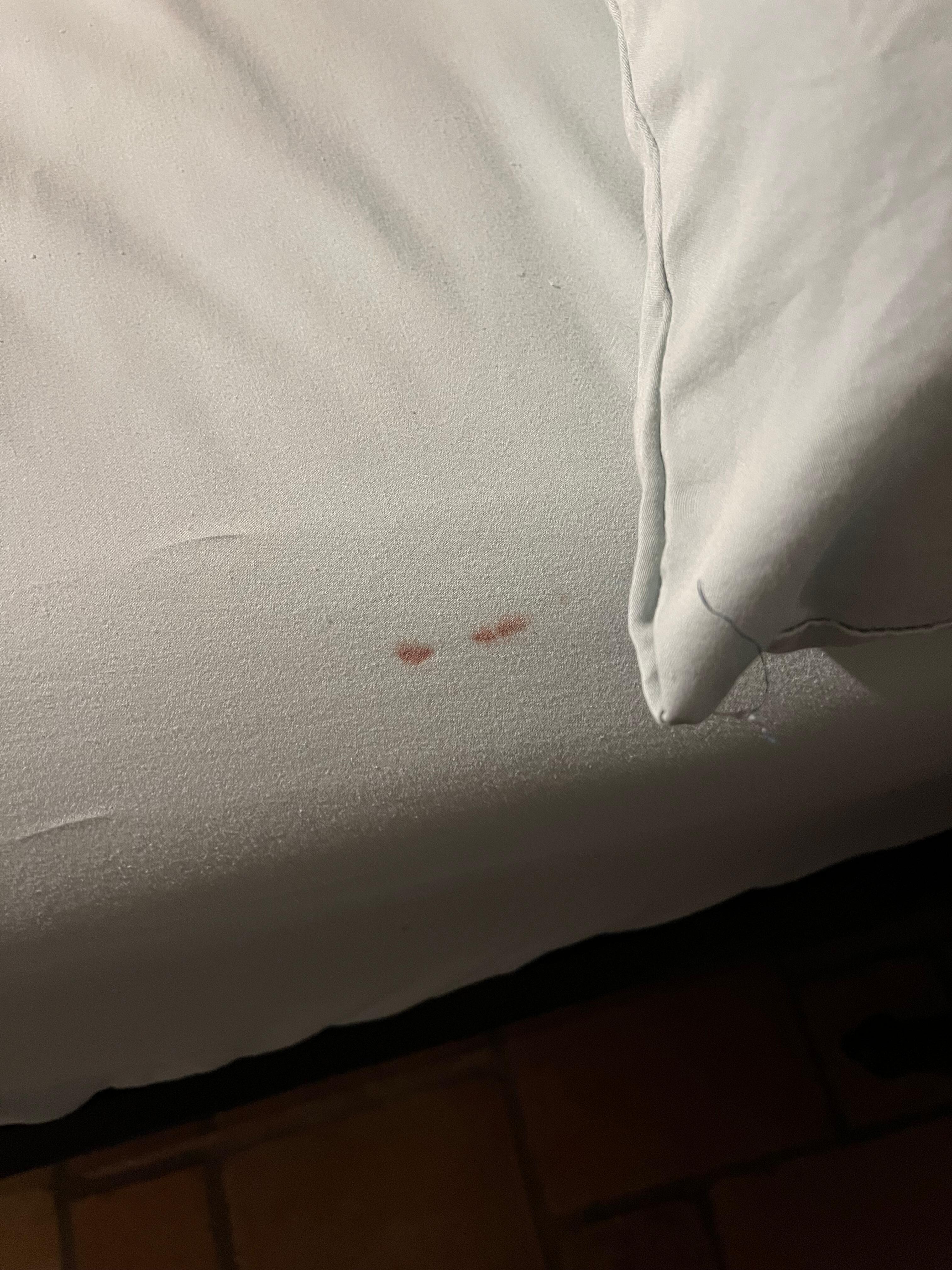 Stains on master bed