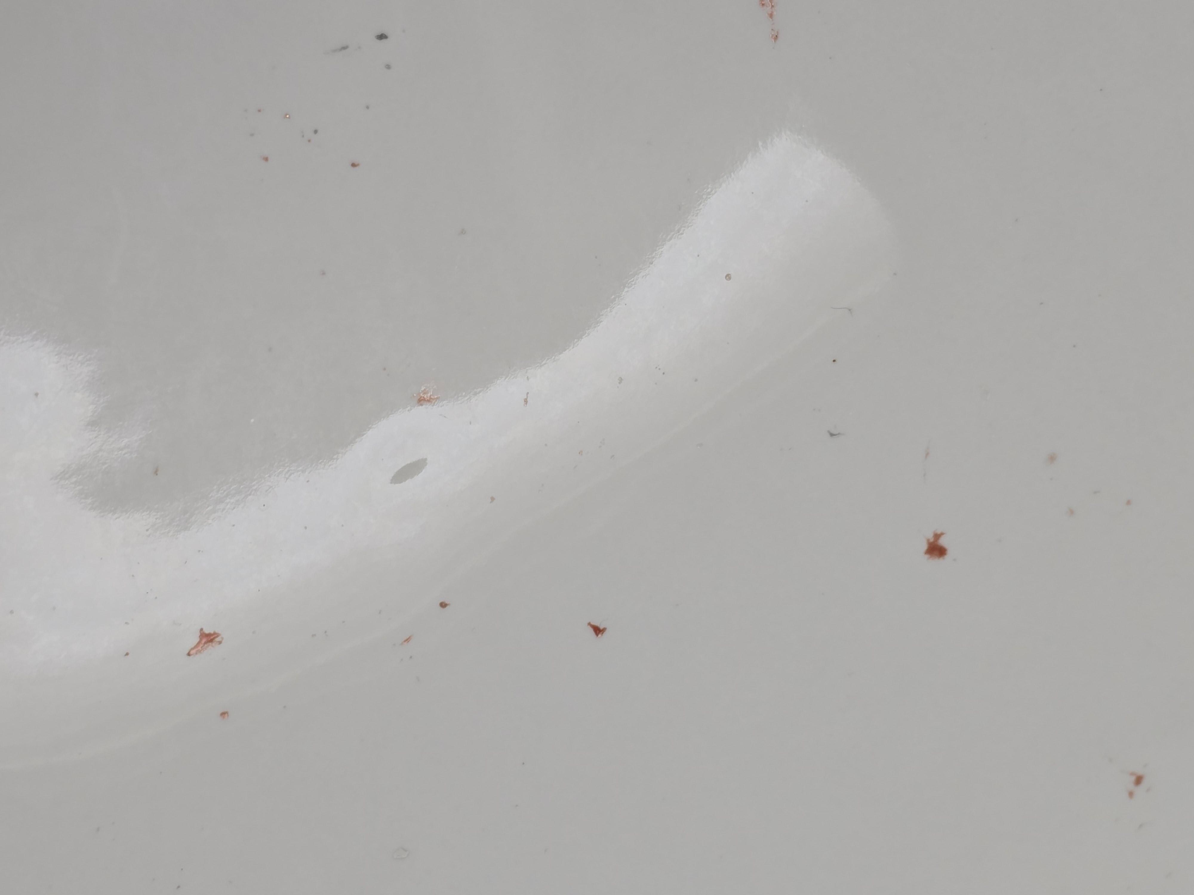 Closer view of blood in the sink