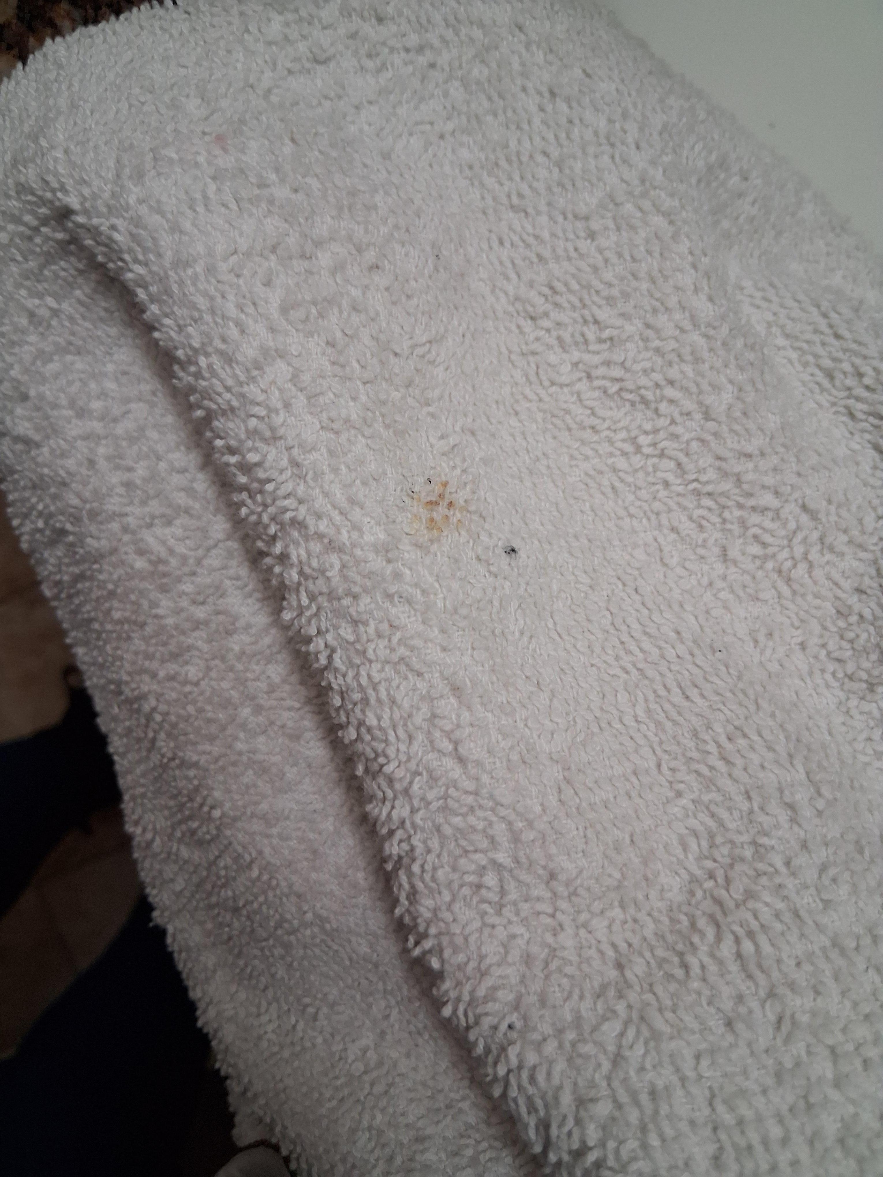 Nasty poop stains on towels💩