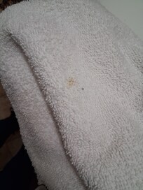 Nasty poop stains on towels💩