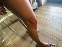 Ma compagne a pris le tiroir cassé sur le genou