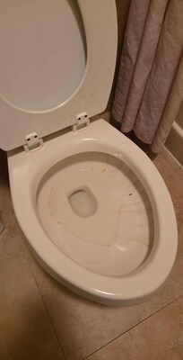 The toilet as well as the shower was moldy, covered in old excrements, hair, and general filth.