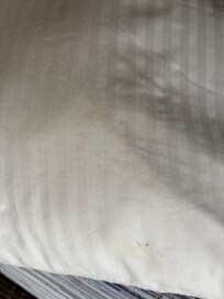Stains on pillowcase