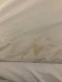 Stains on bef