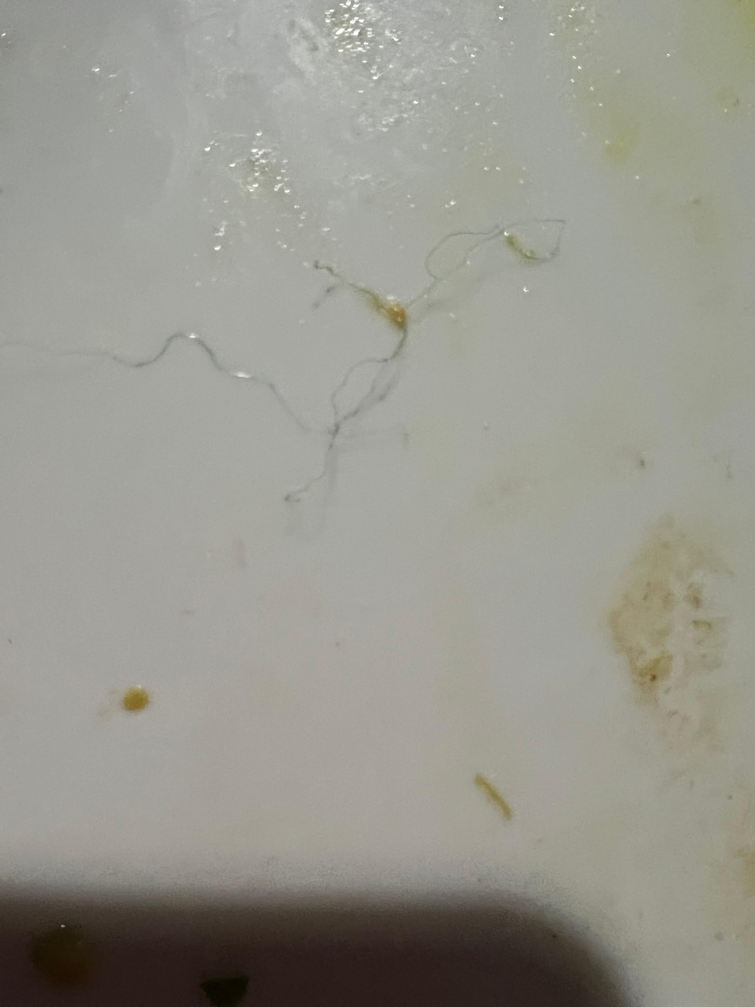 15 Sponge fibers in food 