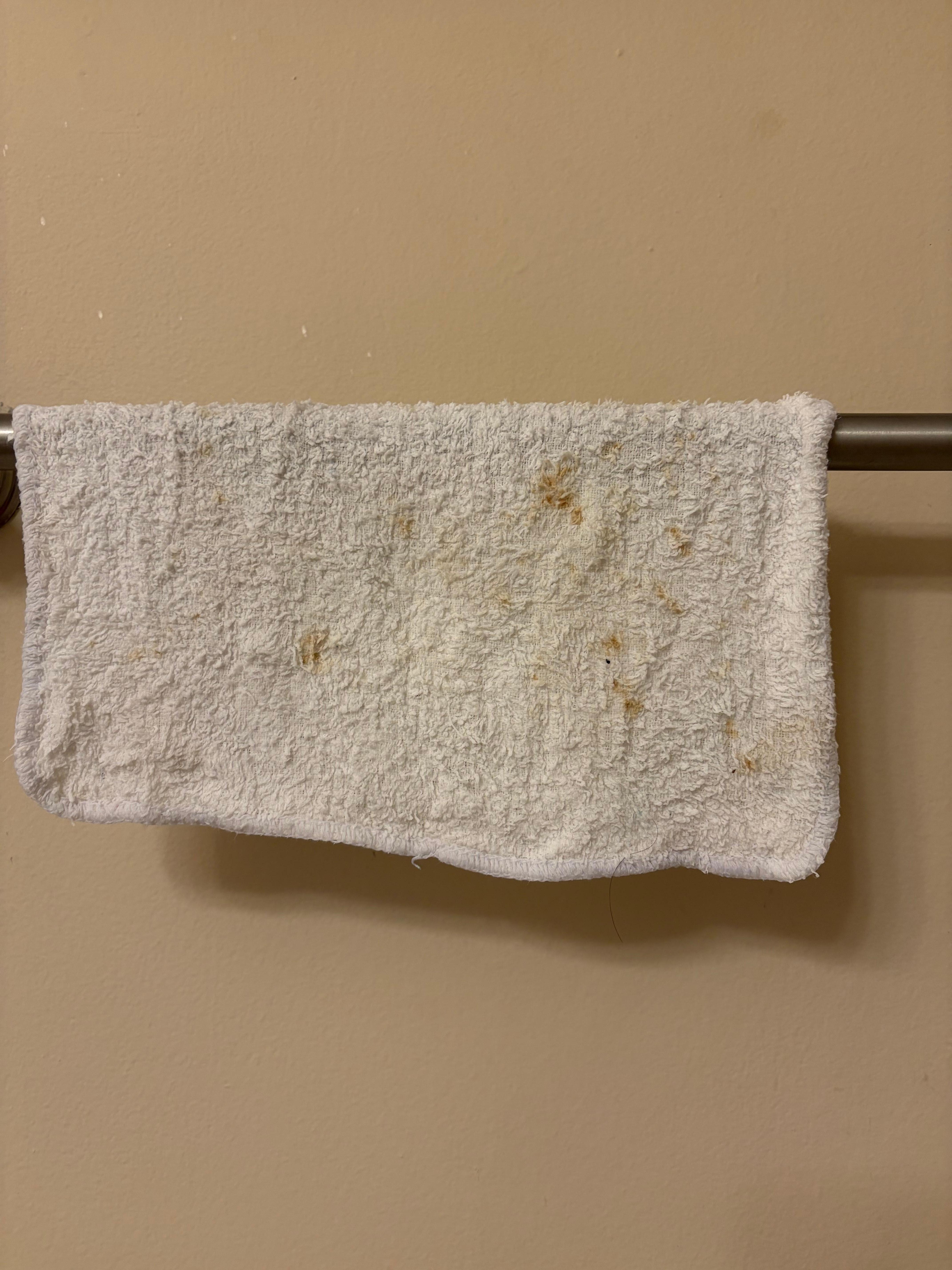 This was the ONE towel that was there folded up as if it was to be used 