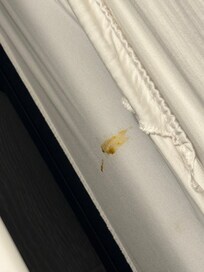 Closer view. So gross