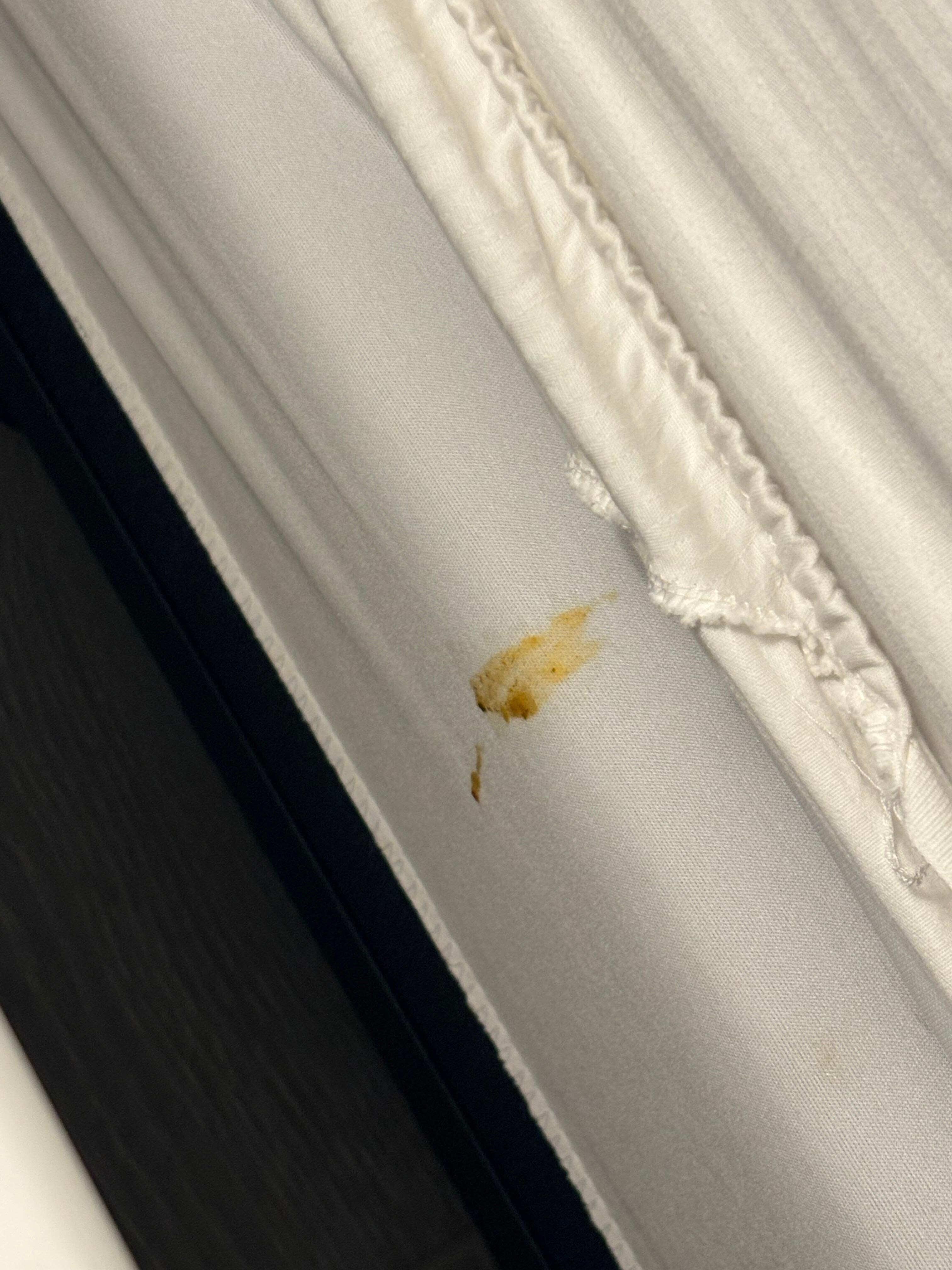 Closer view. So gross