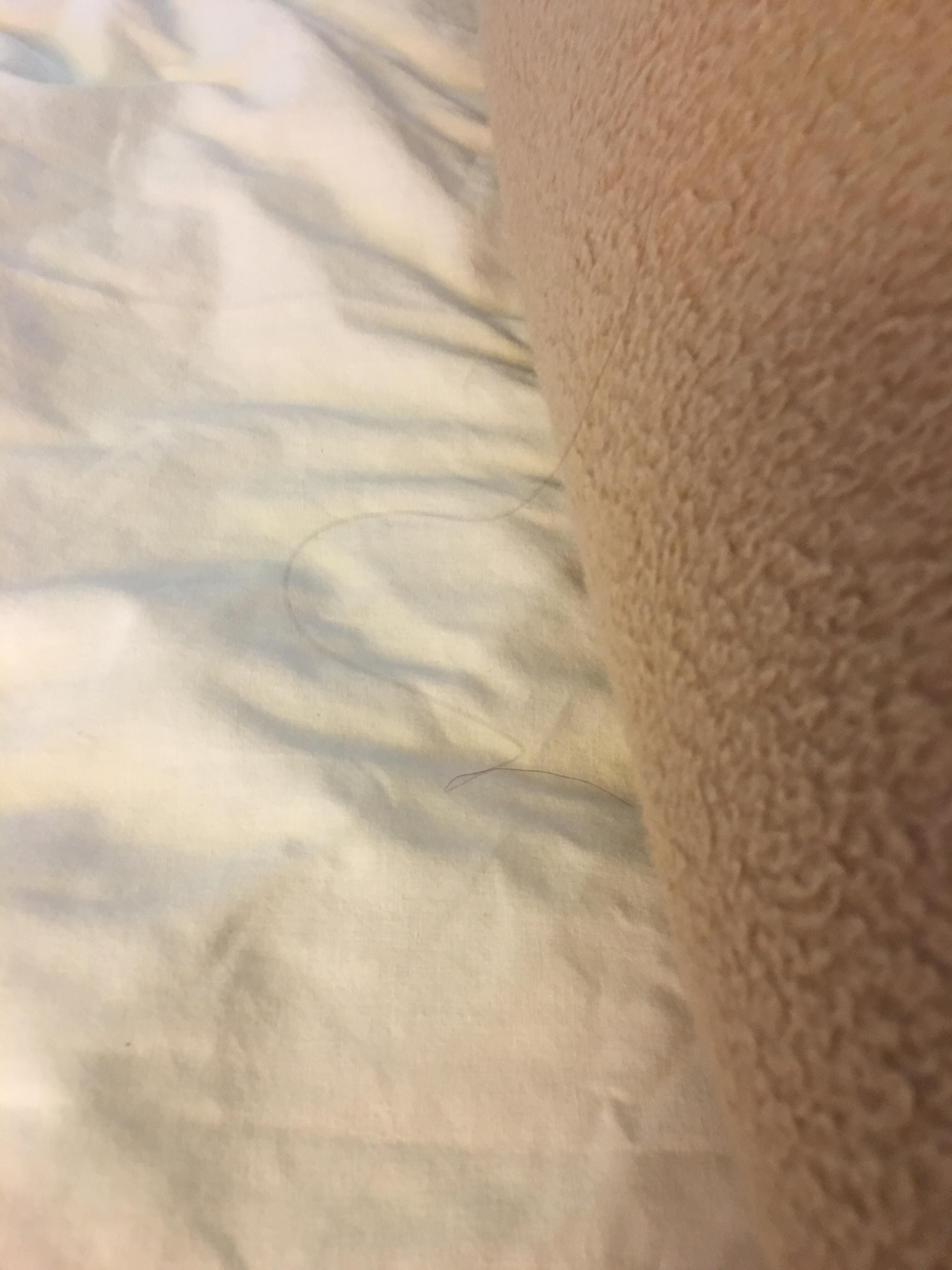 Bed Bug poo
