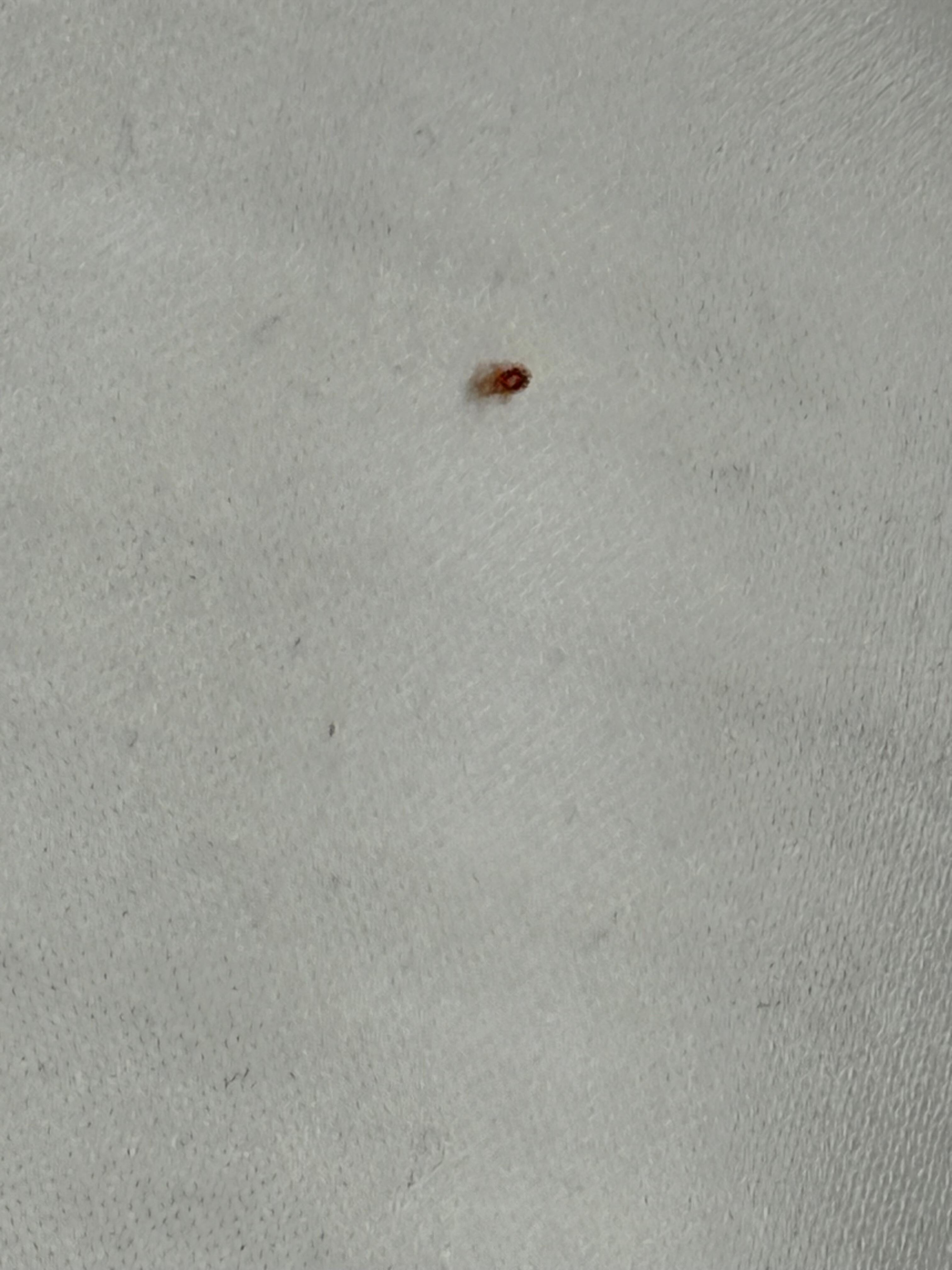 Baby bed bug