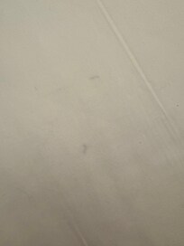 Hairs directly under the sheet