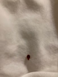 This a called a bed bug.