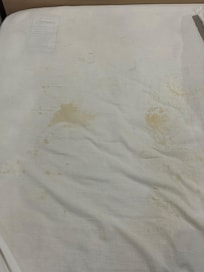 very dirty bed sheets on both beds