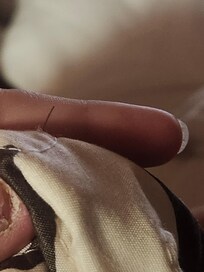 Needles in the blanket