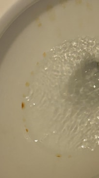 Toilet bowl