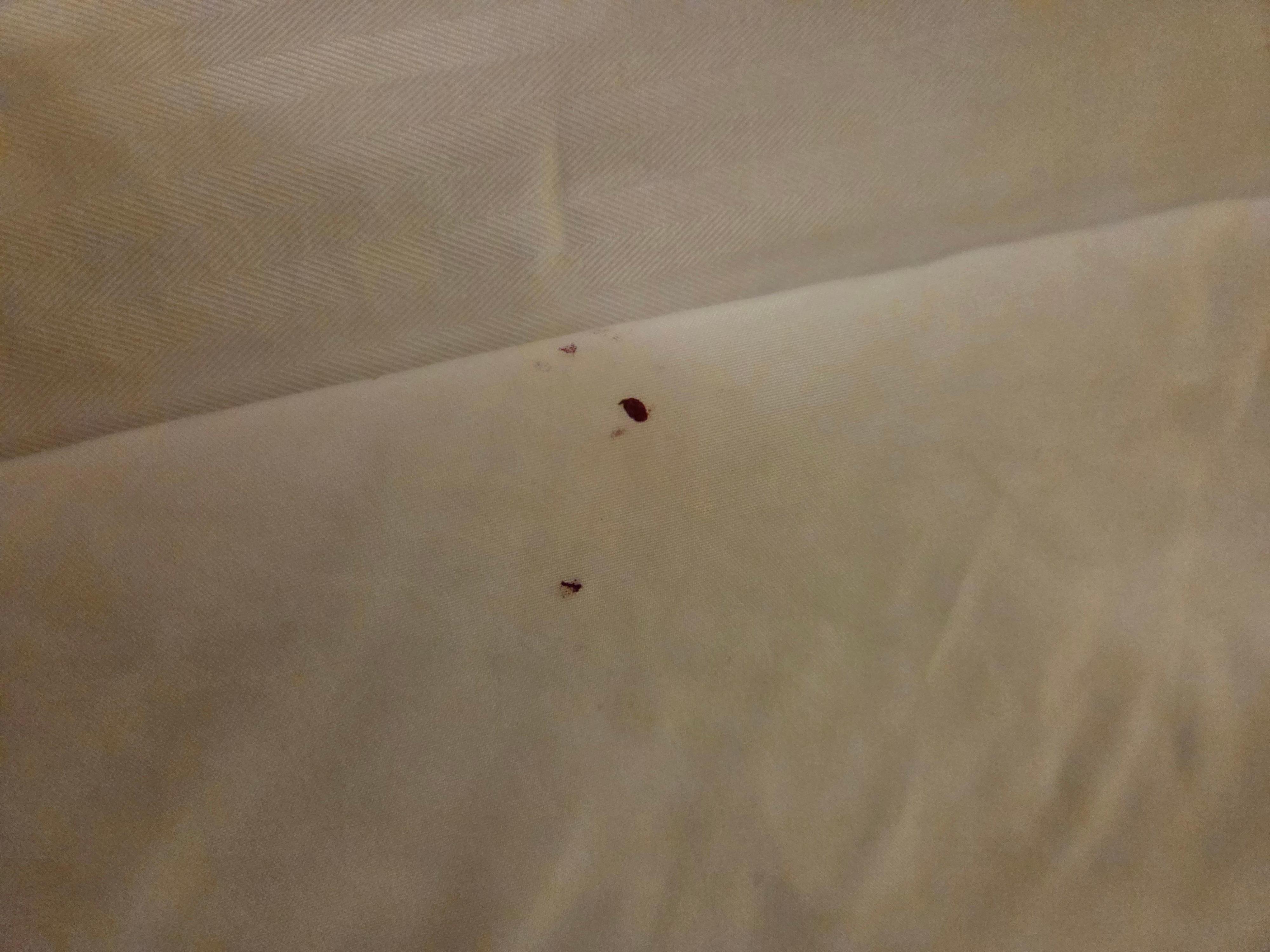 Blood on sheets