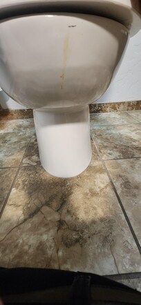 Dirty Toilet