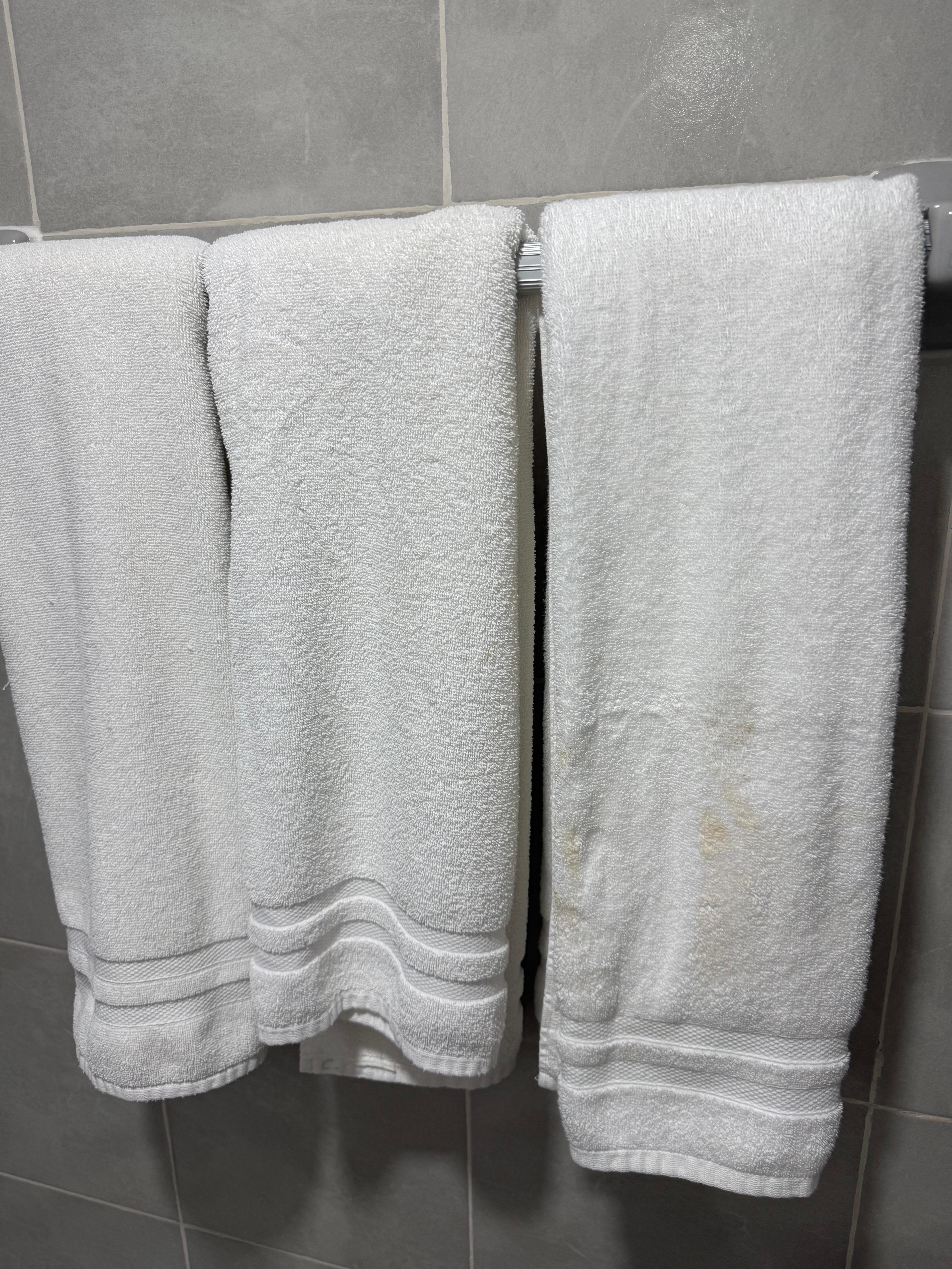 Towel to the right has yellow stains