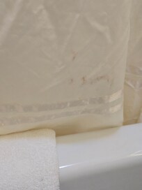 Stains on bath curtain